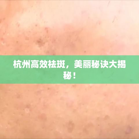 杭州高效祛斑，美麗秘訣大揭秘！