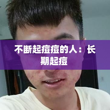不斷起痘痘的人：長(zhǎng)期起痘 