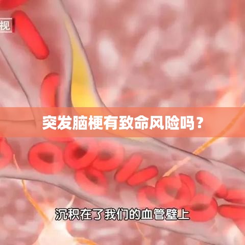 突發(fā)腦梗有致命風(fēng)險(xiǎn)嗎？