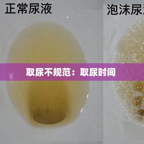 取尿不規(guī)范：取尿時間 