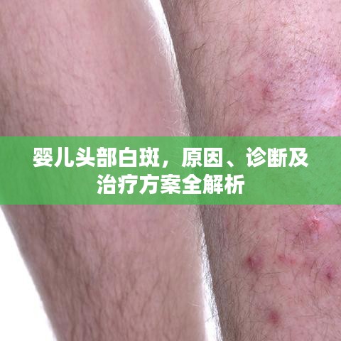 嬰兒頭部白斑，原因、診斷及治療方案全解析
