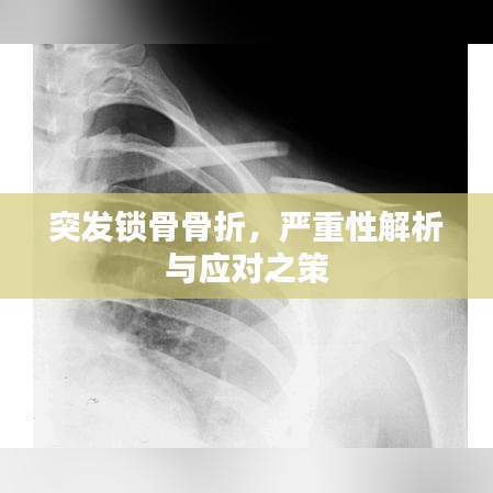 突發(fā)鎖骨骨折，嚴重性解析與應對之策