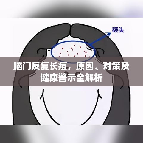腦門反復(fù)長痘，原因、對策及健康警示全解析