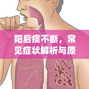 陽后痰不斷，常見癥狀解析與原因探究
